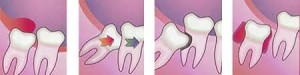 οδοντιατρείο κολωνάκι dentalsmiles